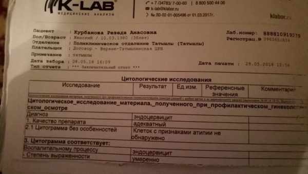 Аналіз 70 метаболітів крові допоможе виявити будь-який рак на ранній стадії