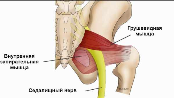 Симптоми приземлення сідничного нерва у жінок