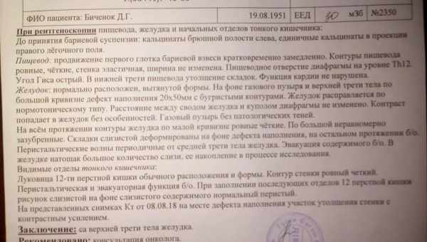 Вилучення комок Біша: свідчення, протипоказання, результати