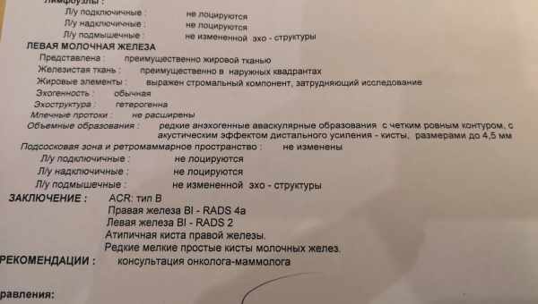 Чим відрізняється мамографія від УЗД молочних залоз і що з них краще