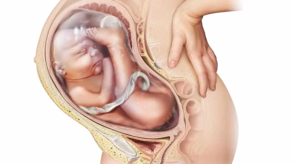 Опущення матки при вагітності