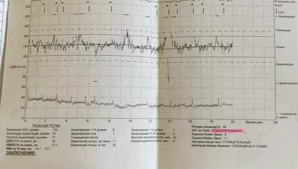 Серцебиття плоду - показники норми, методи контролю, патології