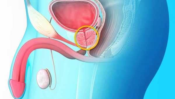 Народна медицина в боротьбі з простатитом
