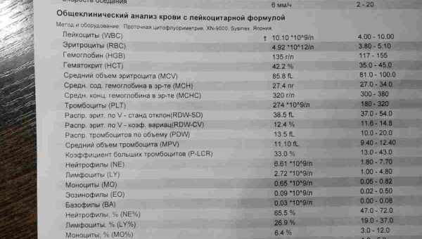 На Мадагаскарі кров на аналіз почали возити на безпілотнику