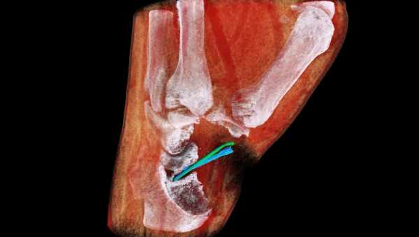 Перший у світі кольоровий 3D-рентген: як зазирнути всередину організму без розтину