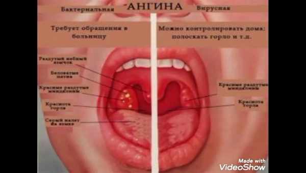 Біль і закладеність у горлі